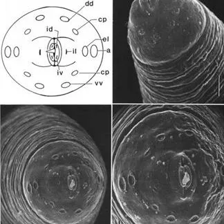 thumbnail for publication: Pork Worm Trichinella spiralis (Paget, 1835) (Nematoda: Enoplea: Trichocephalida: Trichinellidae)